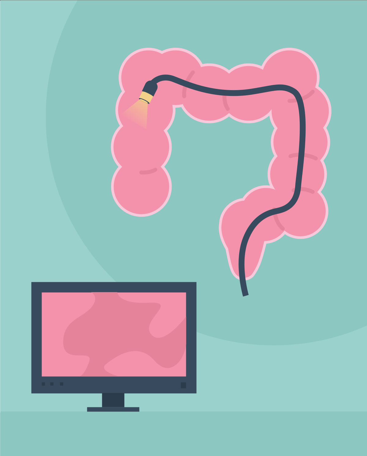 Colonoscopy - what is it and how do you prepare for it?