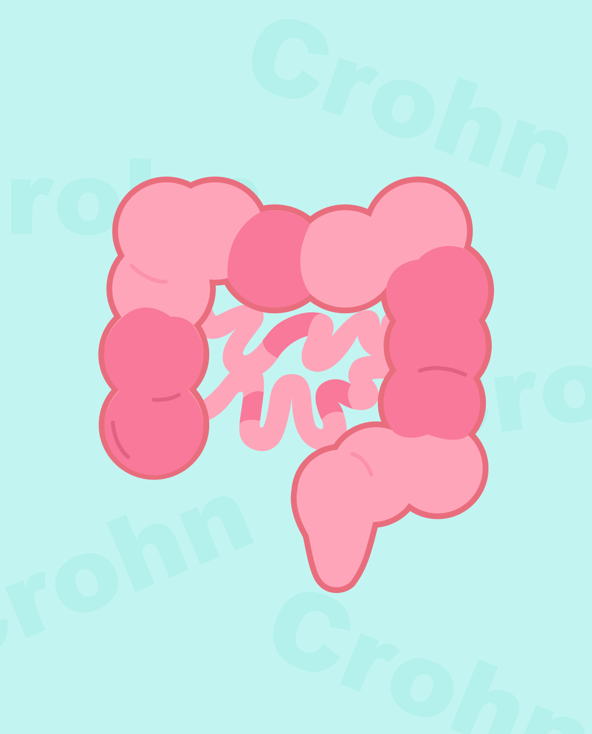 crohn-s-disease-synappsehealth