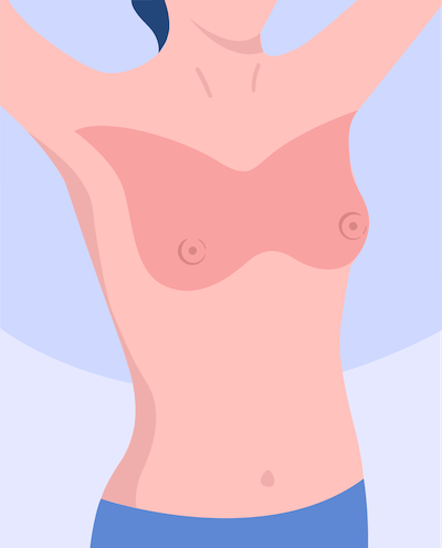 breast self examination