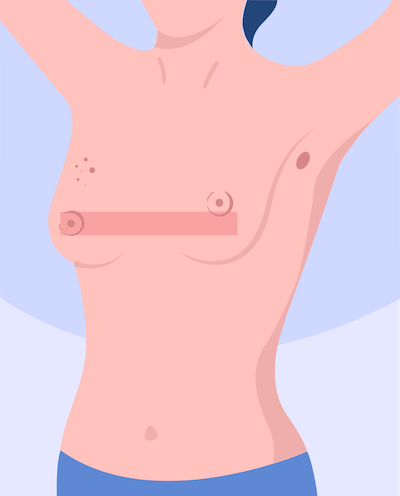 breast self examination