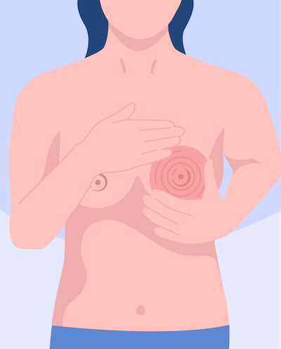 breast self examination