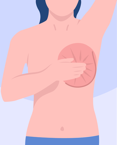 breast self examination