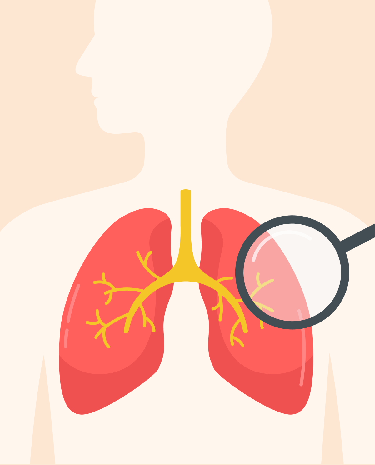 Restrictive pulmonary disease overview